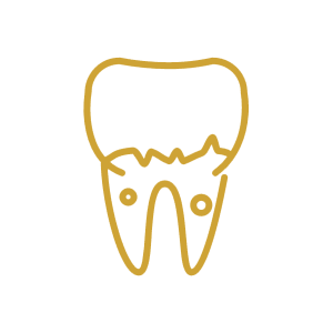 Endodontia (Canal)